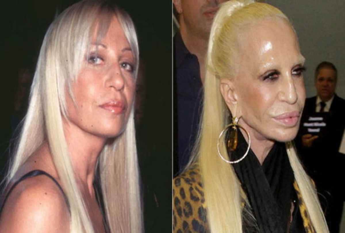 farhan abraham to lil kim all stars look ugly after plastic sugery