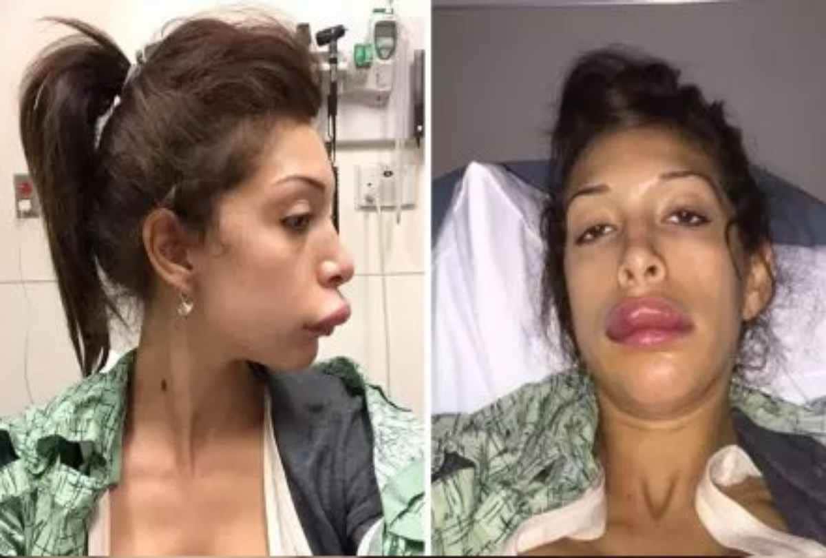 farhan abraham to lil kim all stars look ugly after plastic sugery