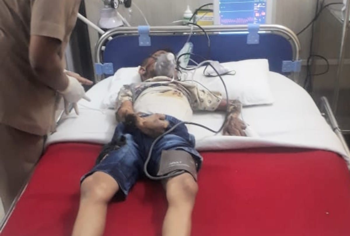 Boy Electrocuted Stuck To Pole in Kasauli Solan Himachal Pradesh