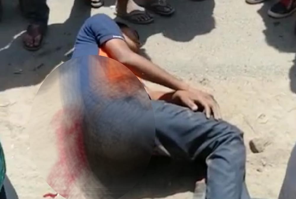In the encounter, the bullet removed from the foot of the injured prize crook