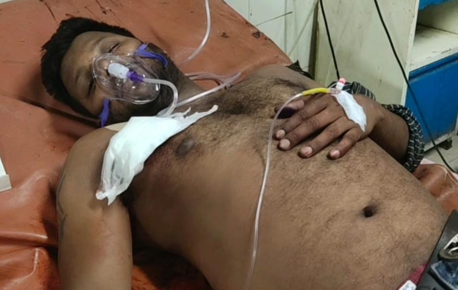 History Sheeter has shot himself in Prayagraj