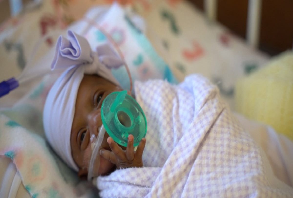 World Smallest Baby Girl Released From Hospital In US
