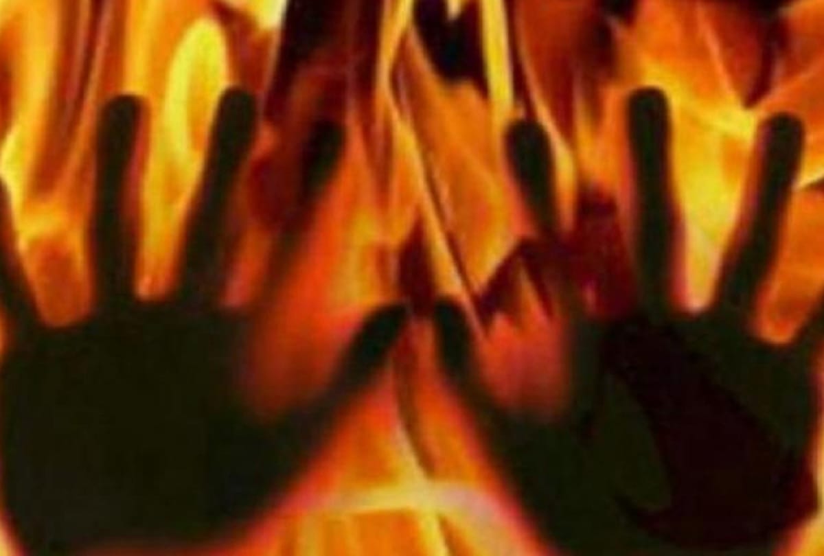 A 17-year-old girl was set ablaze allegedly by a man to reject his proposal