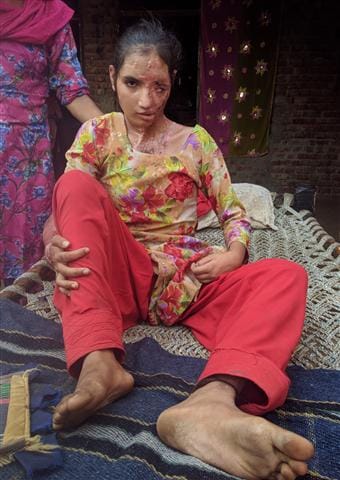 Acid attack victim Divyaung Gulshana seeking mercy of Ramzan