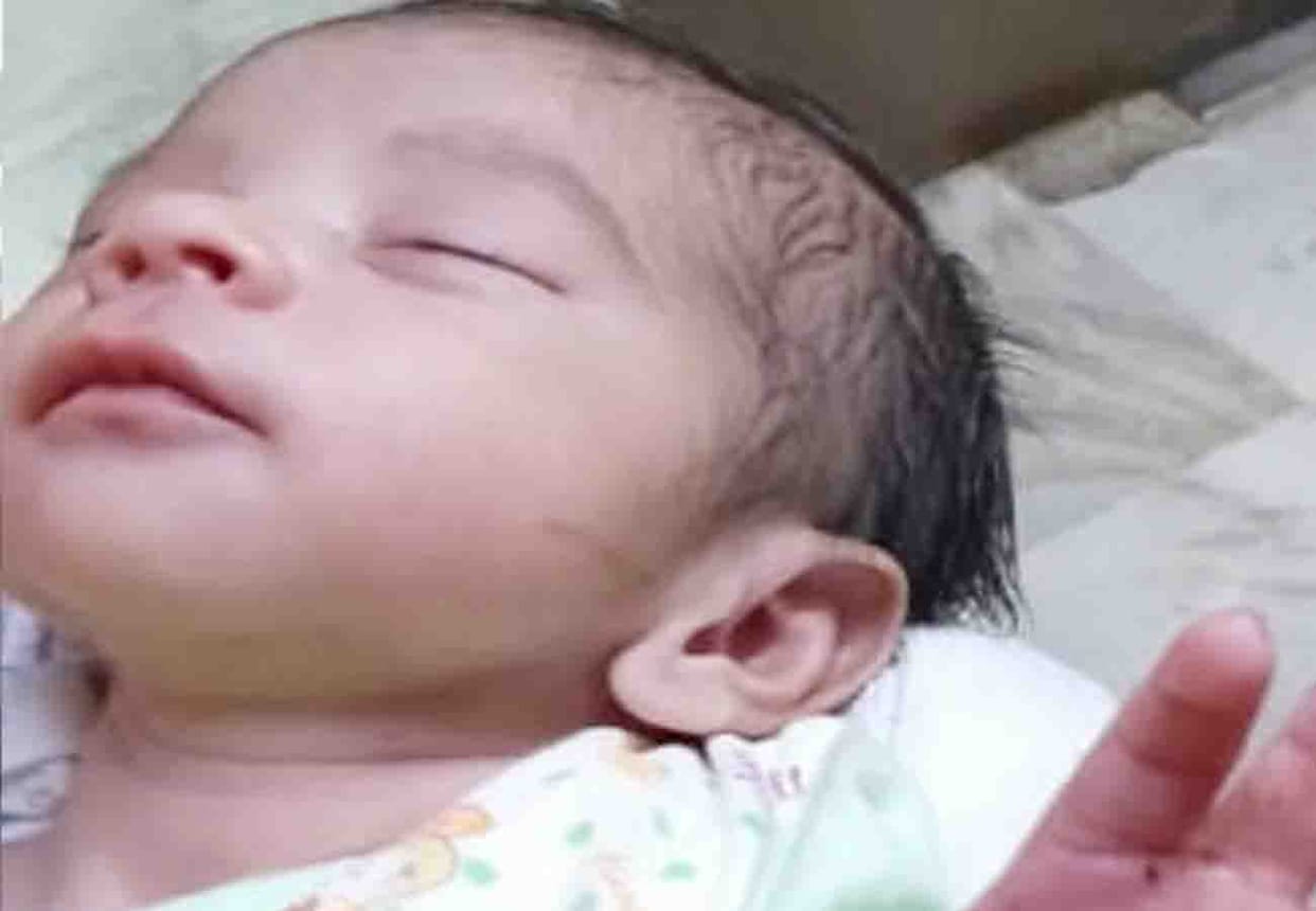 Newborn baby thumb cut by a nurse in hospital