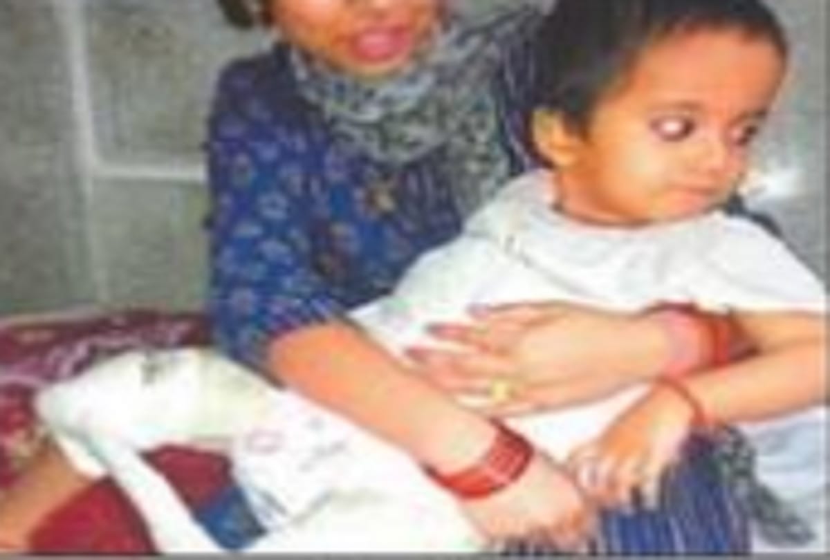 Due to negligence of the doctors baby girl loose their lags
