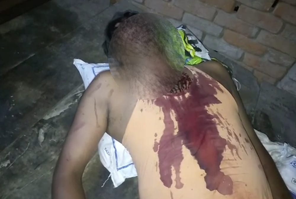 Attack on BJP booth worker in Gonda.