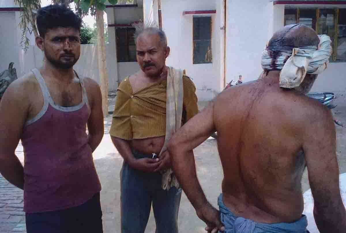 8 people injured in land dispute at fatehpur