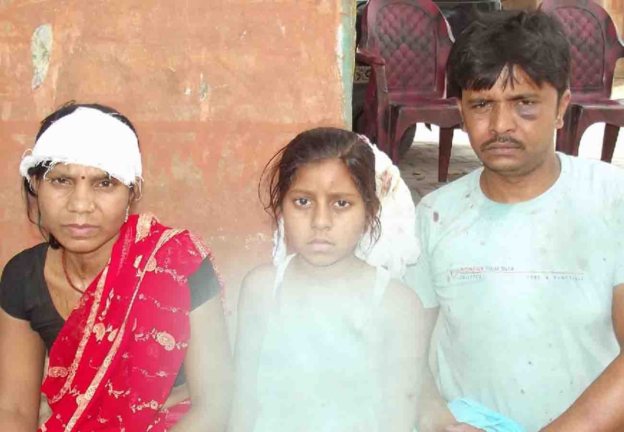 Ten year old girl and her family brutally beaten in dispute of water