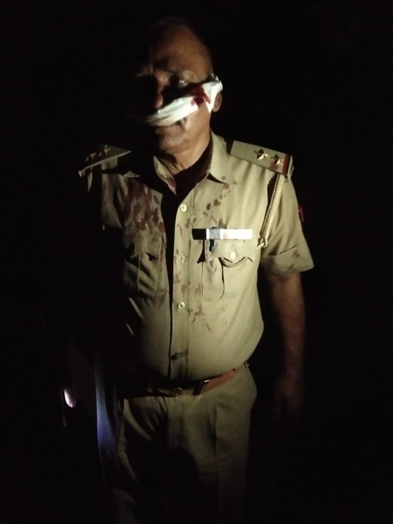 Attack on police team arrested in Prayagraj, two injured including Druga