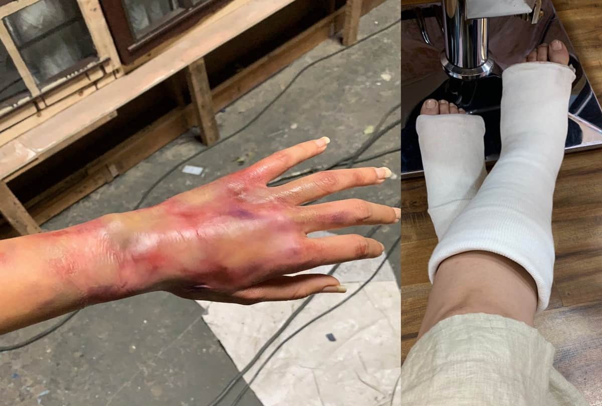 Taapsee pannu Shares Horrble Picture From Sets Of Game Over fans pray for her health