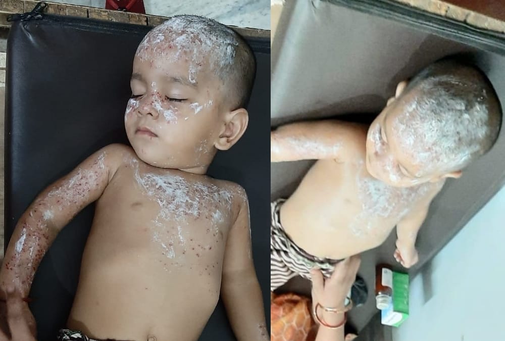 Three inured in firing in Kakori in Lucknow.