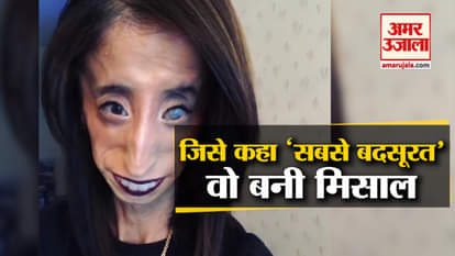 The World Ugliest Women Lizzie Velasquez becomes inspiration for thousands people