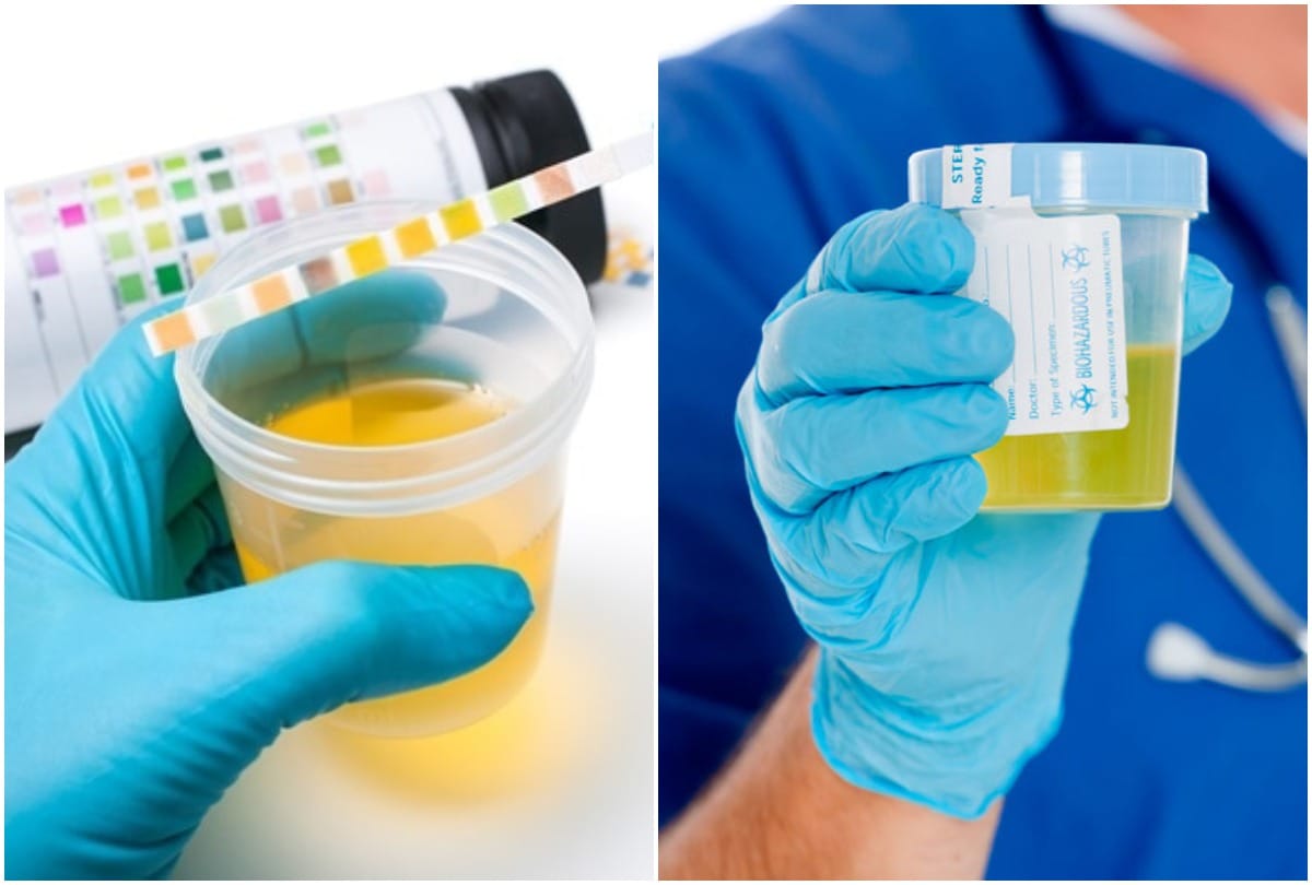 urine infection symptoms and causes