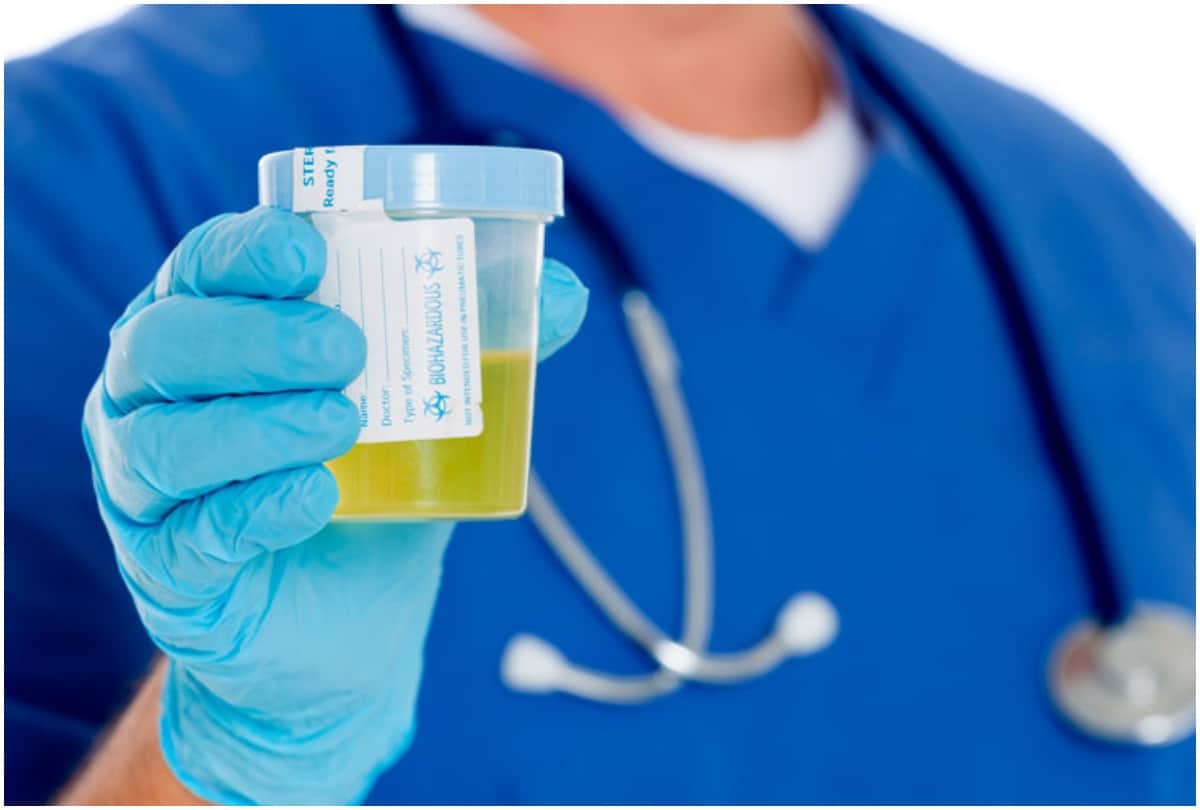 change in urine color and disease alert, know about urine color and indication