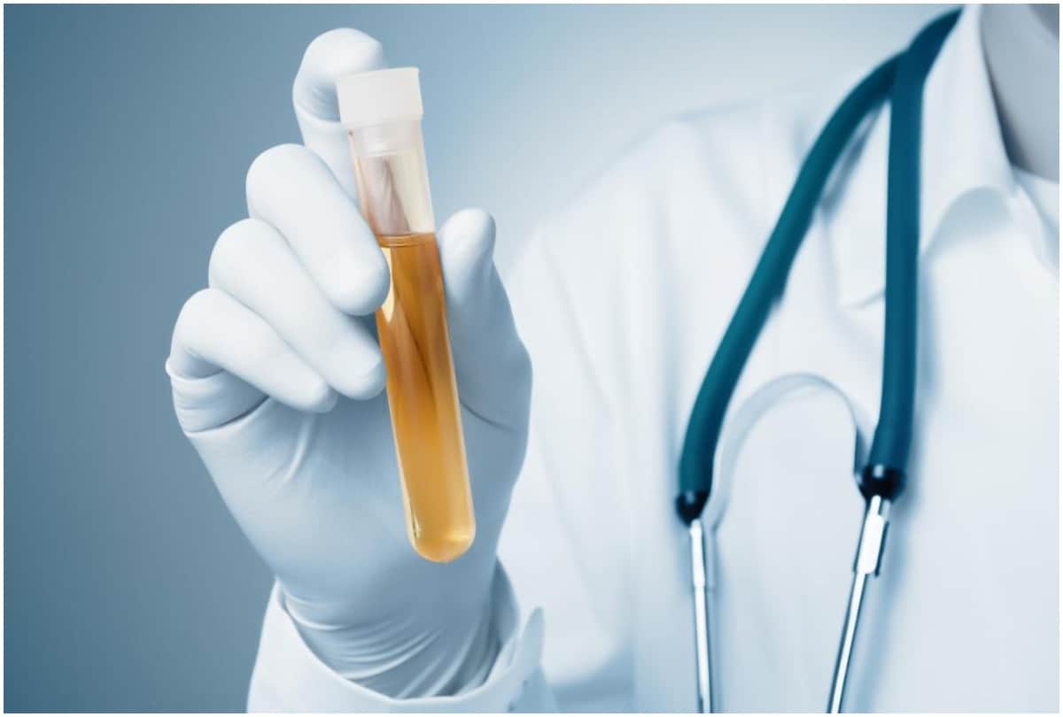 change in urine color and disease alert, know about urine color and indication