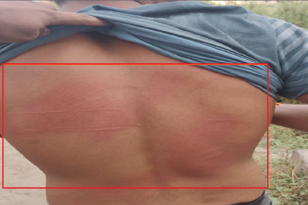 class one student brutally beaten up if he could not recite the mantra, case filed against teacher
