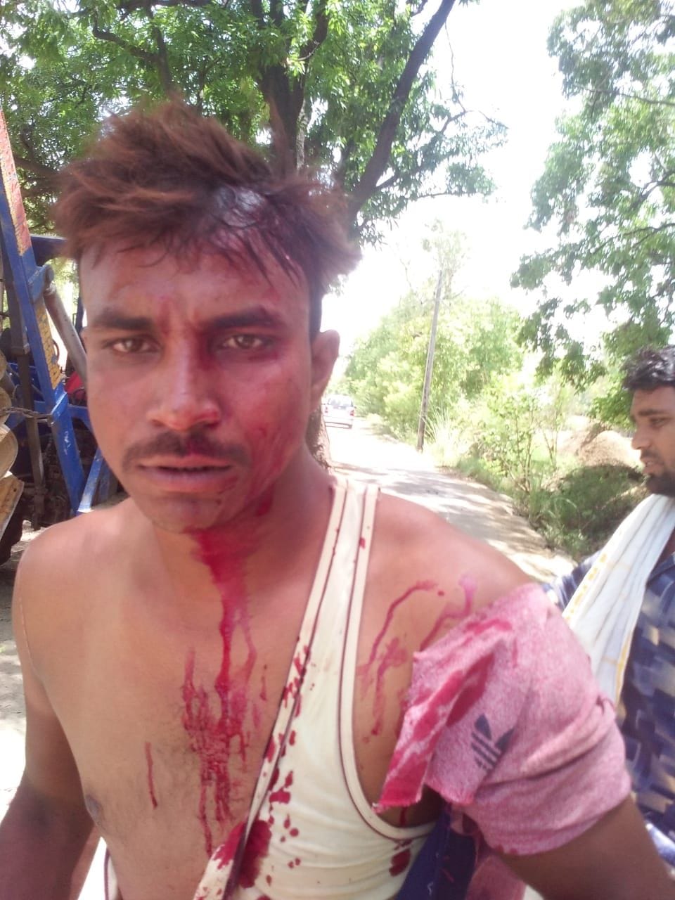 तीन युवकों ने विद्युत कर्मियों को  बुरी तरह पीटा, किया घायल