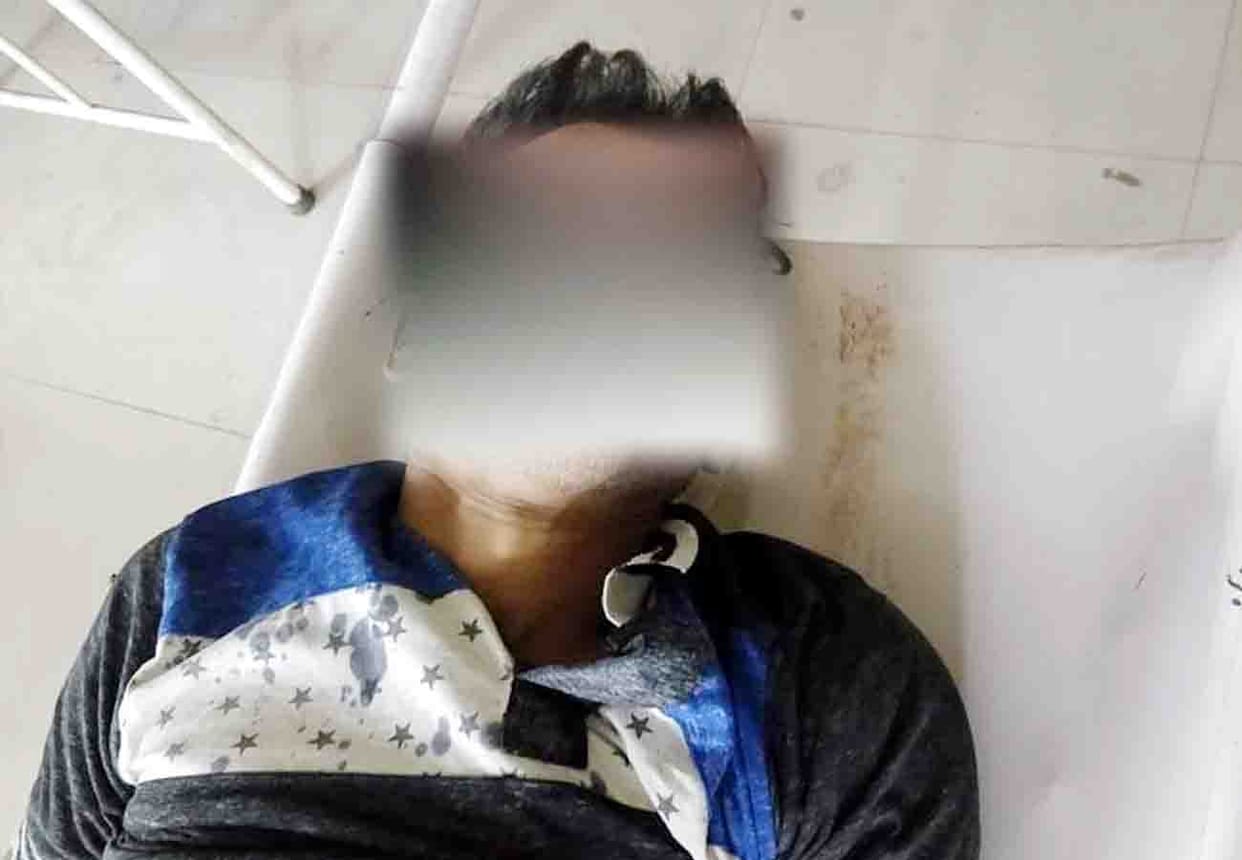 mob beaten thief to death in fatehpur