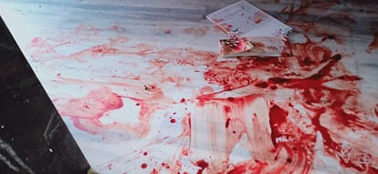 VHP treasurer gets shot by criminals, admitted in hospital