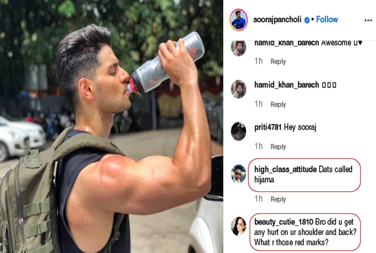 Fans are worried for red Marks on Sooraj pancholi Body, users replied answers