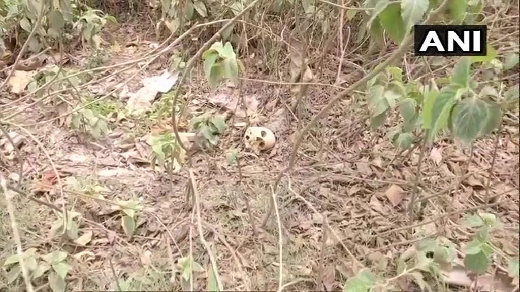 Bihar: Human skeletal remains found behind Sri Krishna Medical College & Hospital, Muzaffarpur.
