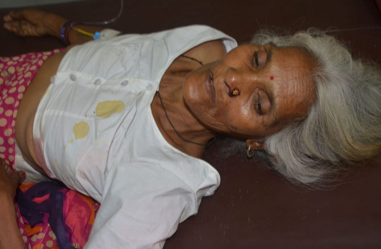 road accident, 17 people injured