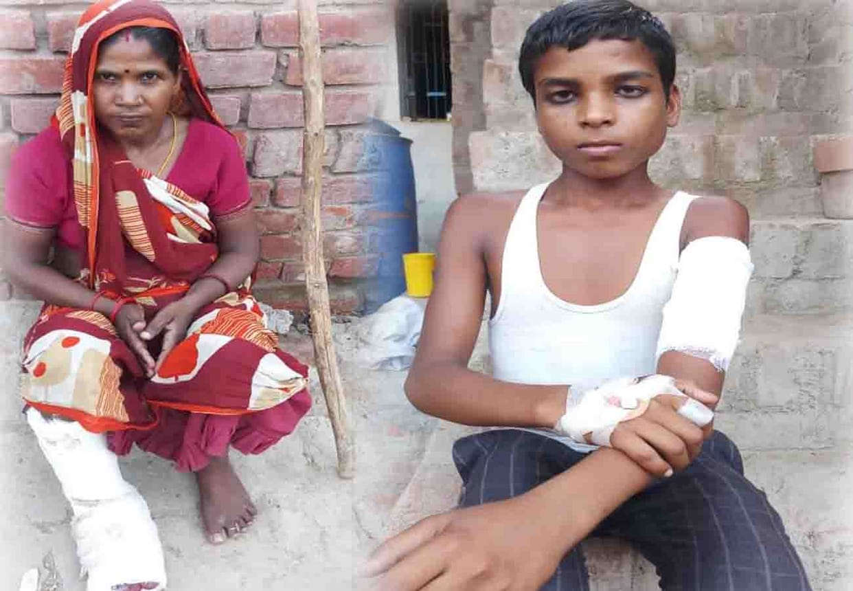monkeys attack on villagers, many people wounded in ghatampur