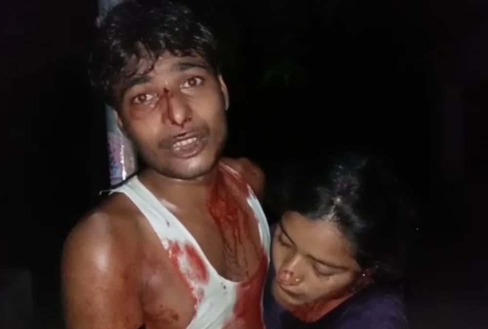 Police men did not help injured brother and sister in police station.