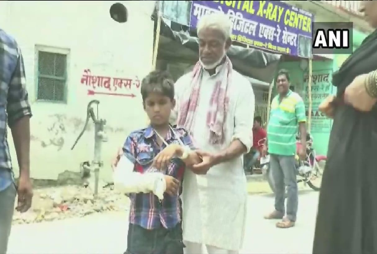 boy right hand was plastered in darbhanga medical college and hospital while left hand was fractured