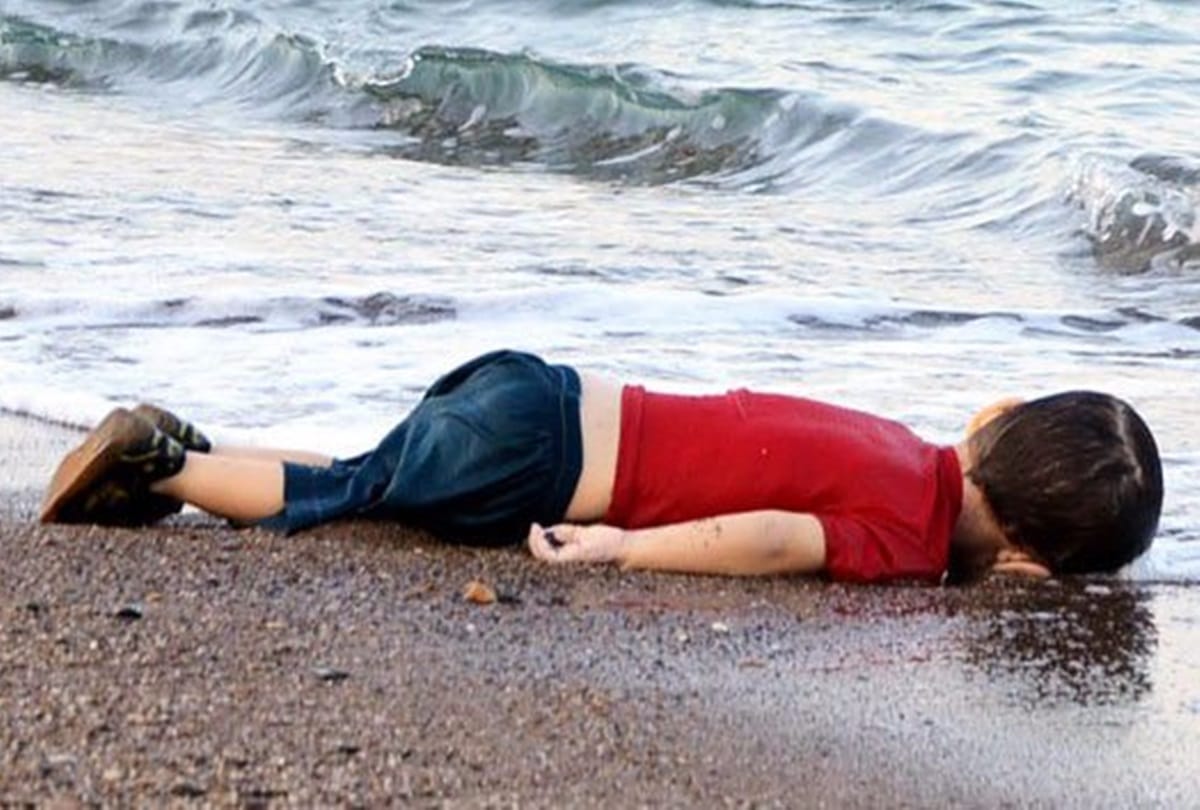 World got shocked to see these Painful Pictures