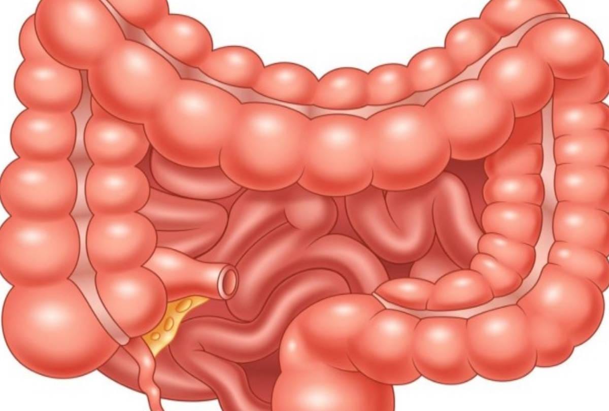 good news for patients of intestine