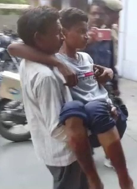 Police beaten teenager