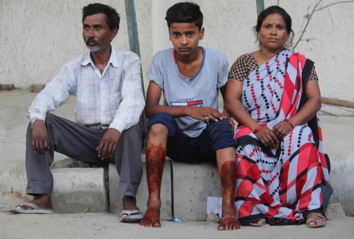 third degree torture by police to a teenager who refused to commit a theft in lucknow