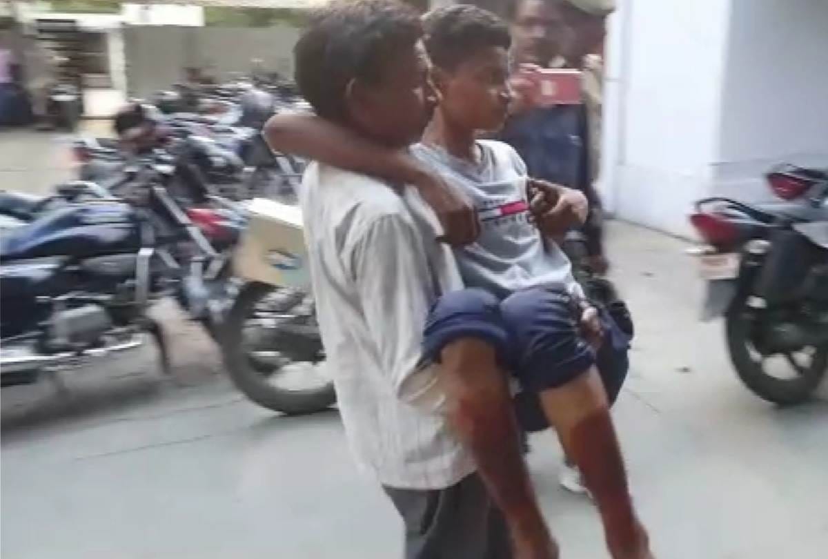 third degree torture by police to a teenager who refused to commit a theft in lucknow