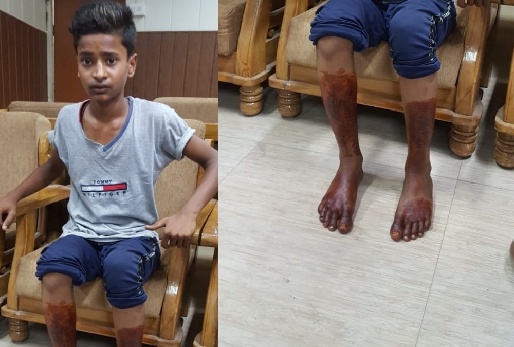 Three suspended for atrocities on a teen aged boy in Lucknow.