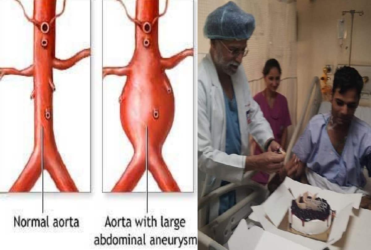 Doctor surgery and take out 20 centimeter Balloon from man stomach in Delhi