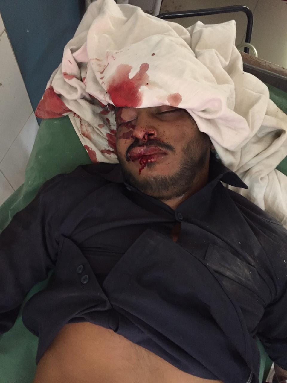 a person dead in road accident