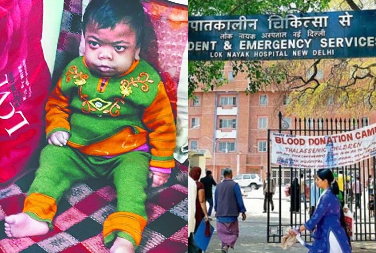 seven-year-old girl dies in Loknayak Hospital due to disease called MPS-1