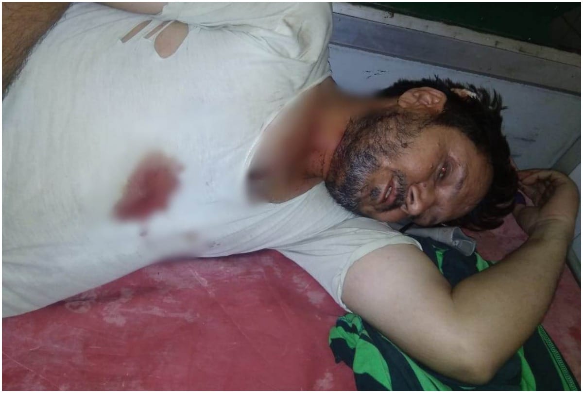 Pragatisheel Samajwadi Party leader Baba Farid Azad attacked, admitted in Hospital