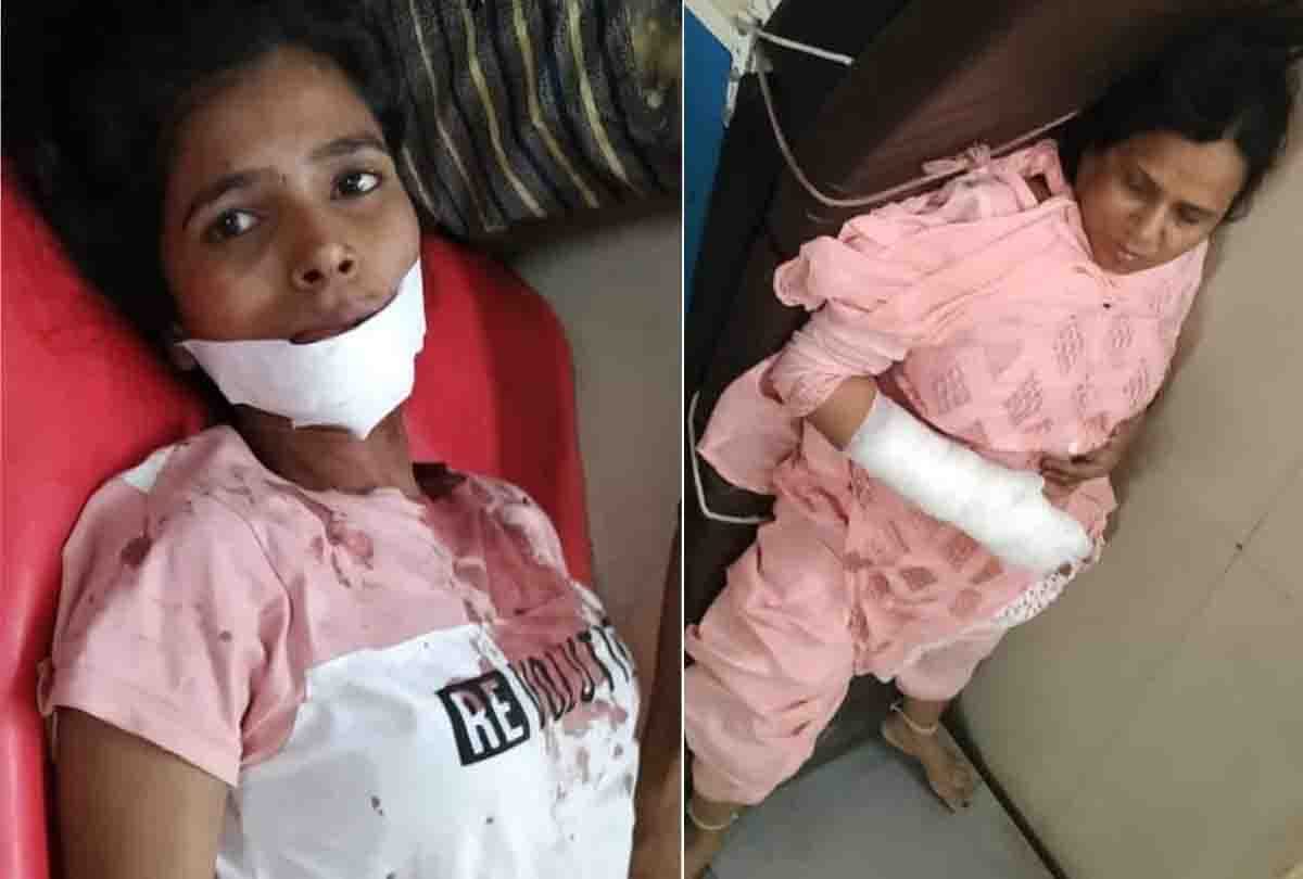 bus accident with dcm in fatehpur 20 injured