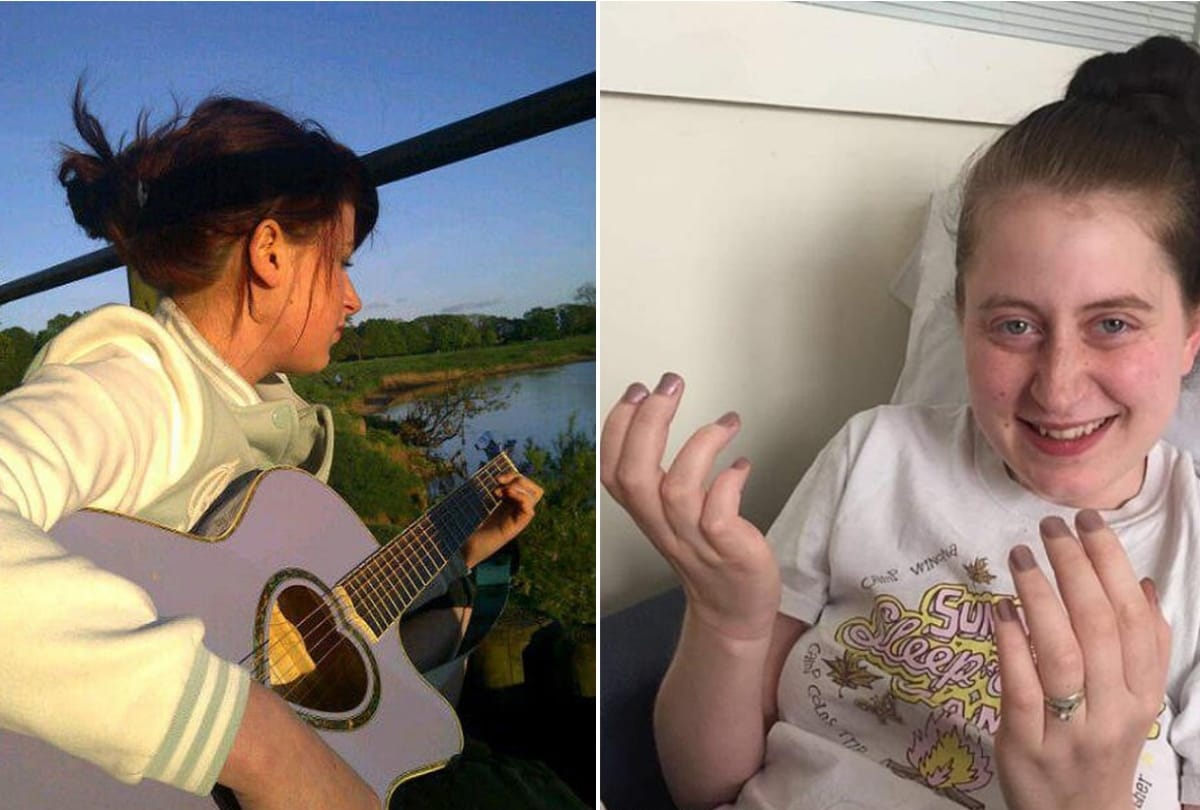 Woman forgot her own wedding due to brain SWELL and wiped her memory