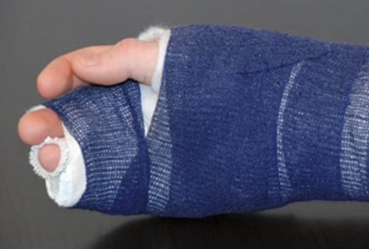 Know How to Heal Fractured Bone Faster in Hindi