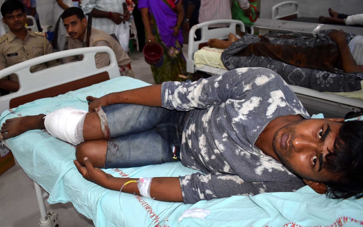 Prayagraj: Strip in the eye, knife shot