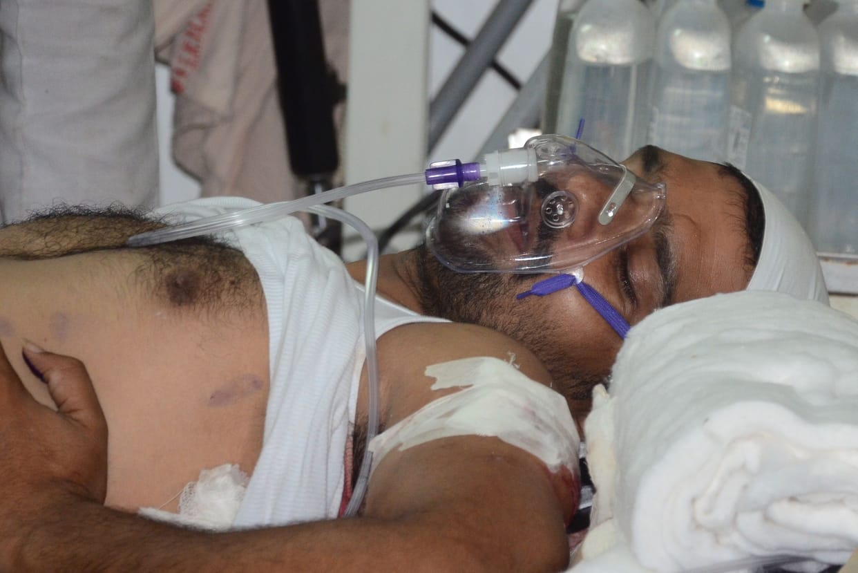 Surrounding BJP councilor, attacking with Mum balls