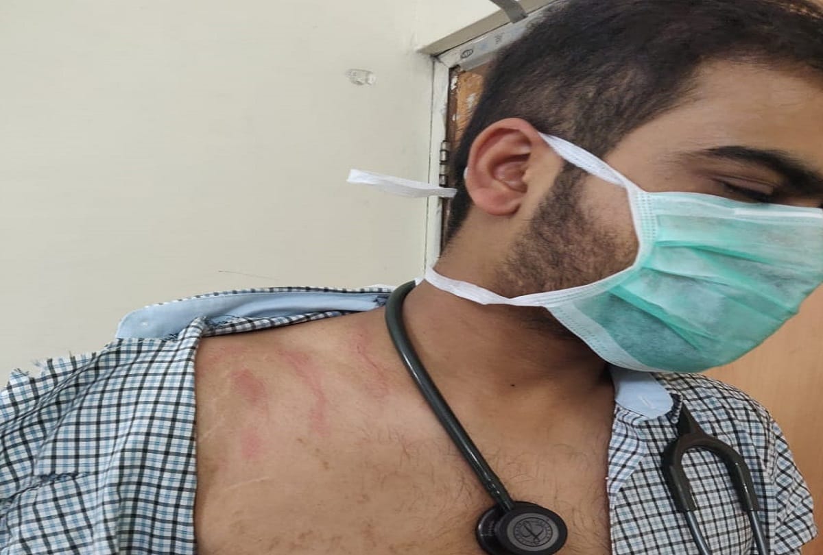 Doctor beaten in Lokayak Hospital delhi Strike announced