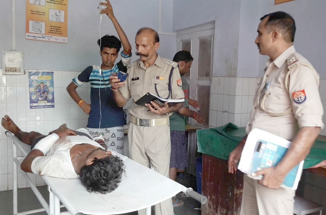 Bullets hit in farming, two brothers injured in farming