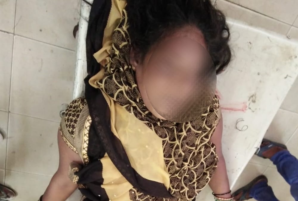 BDC member died becuase of snake bite in Raebareli.