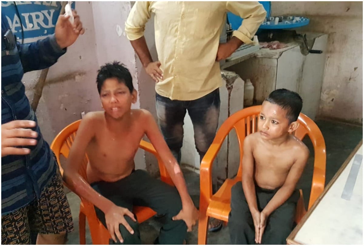 Two children injured during a school Van radiator blast in Gulawathi driver ran off
