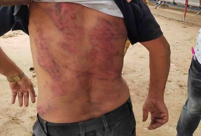 man kidnapped and brutally beaten by kidnapers